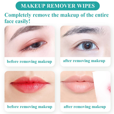 O removedor molhado facial da composição do pacote individual limpa o OEM da marca própria